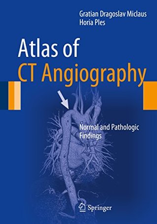 Read Online Atlas of CT Angiography: Normal and Pathologic Findings - Gratian Dragoslav Miclaus | PDF