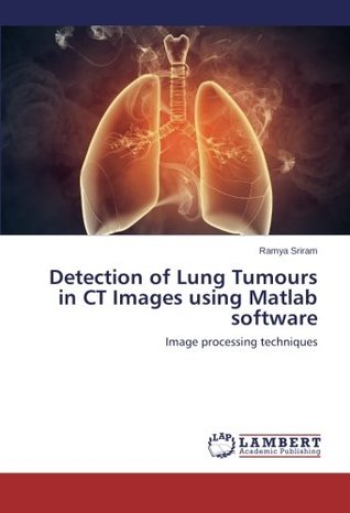 Read Online Detection of Lung Tumours in CT Images using Matlab software: Image processing techniques - Ramya Sriram | ePub