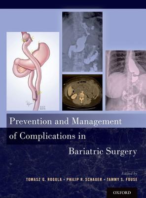 Full Download Prevention and Management of Complications in Bariatric Surgery - Tomasz G Rogula file in ePub