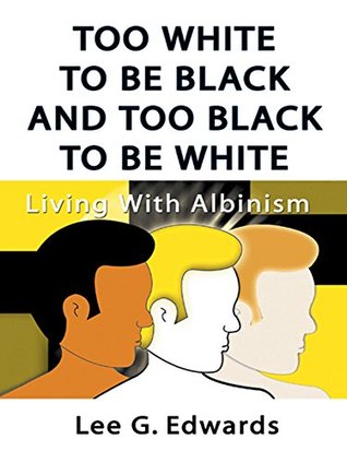 Full Download Too White to Be Black and Too Black to Be White: Living with Albinism - Lee G. Edwards file in PDF