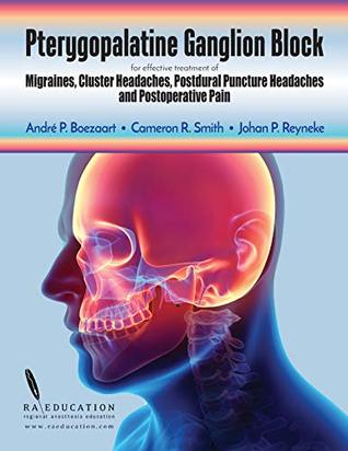 Download Pterygopalatine Ganglion Block: for effective treatment of Migraine, Cluster Headache, Postdural Puncture Headache & Postoperative Pain - Andre P Boezaart | PDF